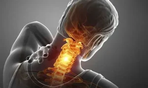درمان گردن درد با ورزش | 7 حرکت ساده برای کاهش سریع درد گردن