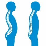 پشتگردی یا کیفوز