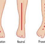 چرخش مچ پا به خارج (Supination)
